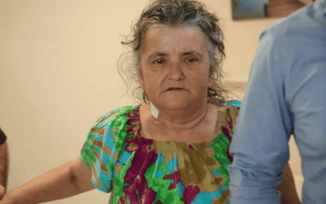 Göbek Fıtığı