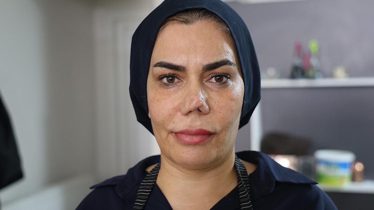 Burnu Kıran Anlaşmazlık