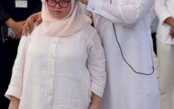 Down sendromlu Hüma